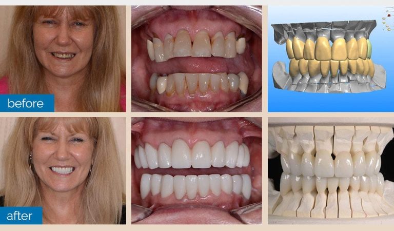 Smile Gallery Premier Dental Center Dentist In Shelby Township Mi 